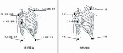 心电美标和欧标接法